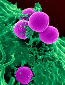 White Blood Cells under an Electron Microscope photo