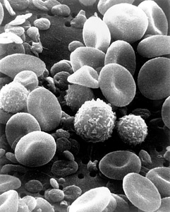 Electron microscope scan blood photo