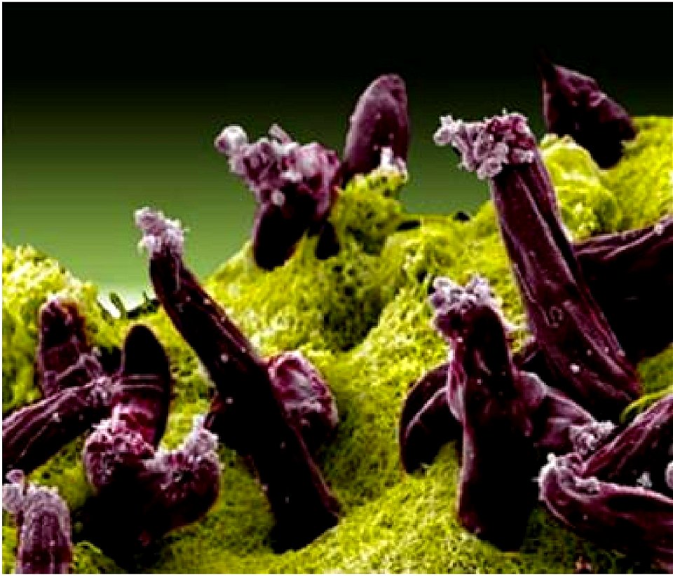 Malaria Plasmodium gallinaceum