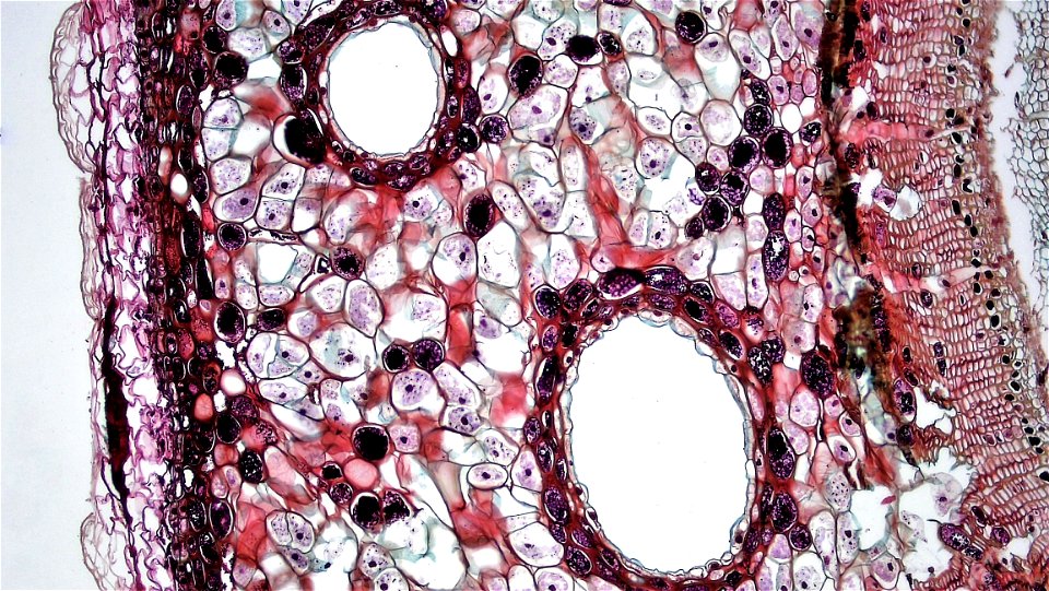 Gymnosperm Stem Cork And Cortex In Three Year Pinus photo