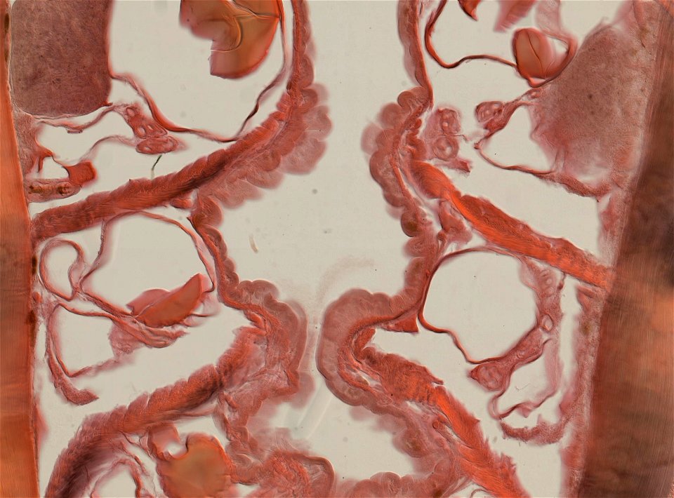 Lumbricus terrestris