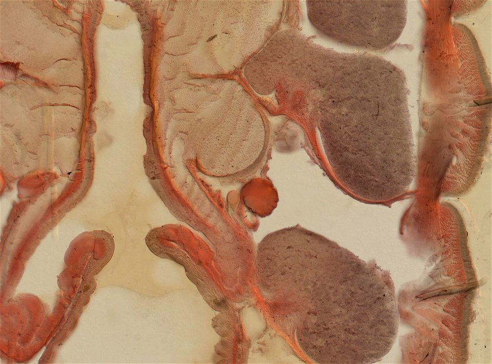 Lumbricus terrestris