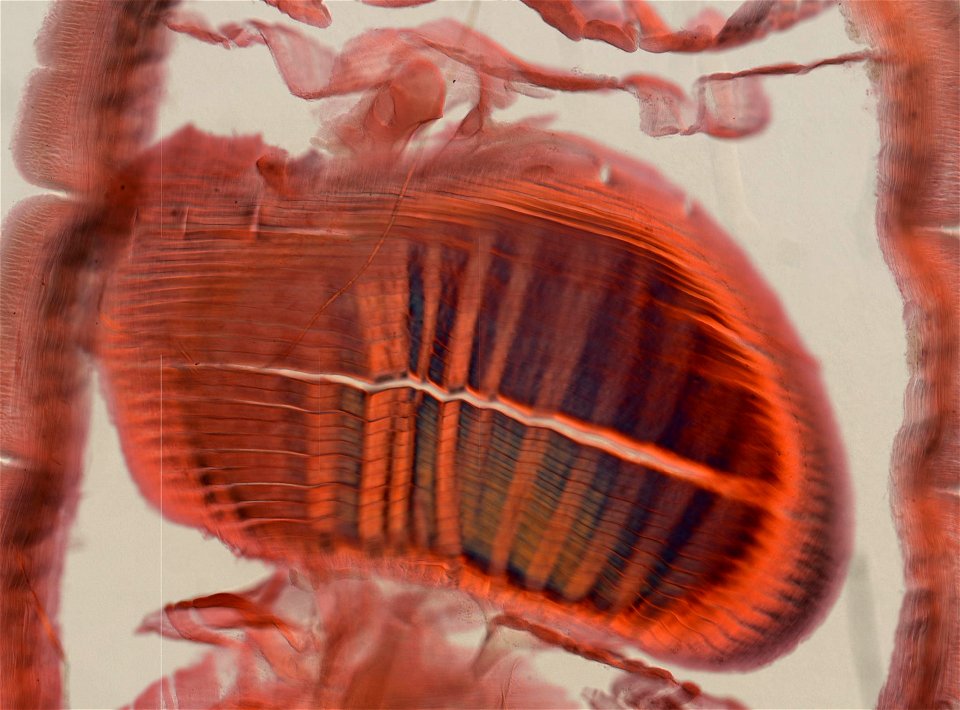 Lumbricus terrestris