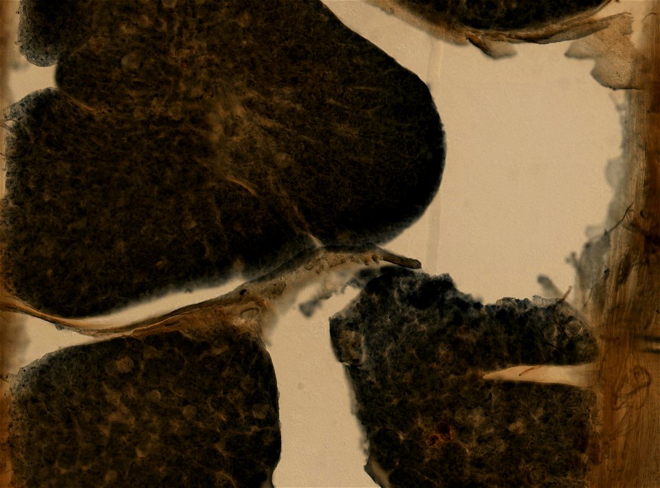 Lumbricus terrestris