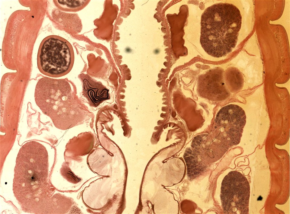 Lumbricus terrestris