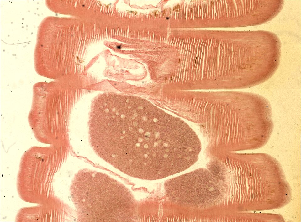 Lumbricus terrestris