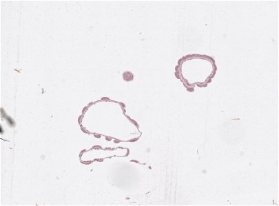 PRESERVED_SPECIMEN; ; ; microslide; IZ number 97602; lot count 1; Microslide 01, balsam, serial section; Microslide 02, balsam, serial section; Microslide 03, balsam, serial section; Microsl