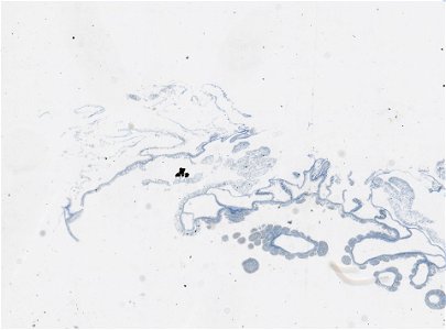 PRESERVED_SPECIMEN; ; ; microslide; IZ number 97613; lot count 1; Microslide 01, balsam, serial section;
