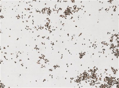 PRESERVED_SPECIMEN; ; ; dry; 70% alc.; microslide; IZ number 27002; lot count 1; Microslide 01, balsam, sclerites; Microslide 02, balsam, sclerites; 2000-12-05T00:00:00Z