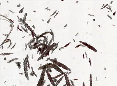 PRESERVED_SPECIMEN; ; ; 70% alc.; microslide; IZ number 10203; lot count 1; Microslide 01, balsam, sclerites; 1893-07-09T00:00:00Z