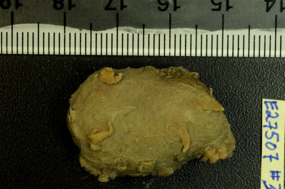 PRESERVED_SPECIMEN; Preparations:	Alcohol (Ethanol); Scotoplanes globosa (Théel, 1879); Individual count:	8; Type status:	 (no data); Identified by:	Agatep, C.; Event date:	19630224T00:00:00Z; Additio