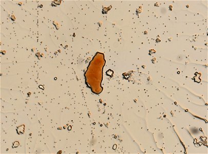 PRESERVED_SPECIMEN; FEMALE; ; microslide; ; IZ number 95154; lot count 1; Microslide 01, glycerin, whole mount; female; other number N-18:III-1; other number P6.14; photo