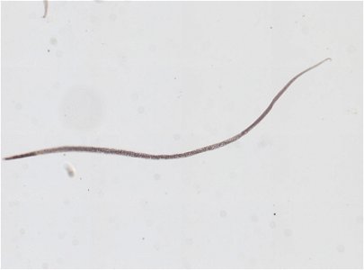 PRESERVED_SPECIMEN; ; ; microslide; ; IZ number 95176; lot count 1; Microslide 01, balsam, whole mount; other number N-18:III-2;