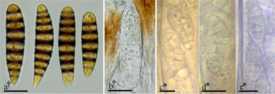 Figure 4; Select examples of ascospore morphologies in Graphidaceae and Leotiomycetes a ascospores of Glyphis cicatricosa in Lugol’s solution b muriform ascospore of Mellitiosporium versicolor c–e mur