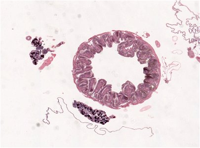 PRESERVED_SPECIMEN; ; ; microslide; ; IZ number 98975; lot count 1; Microslide 01, balsam, salivary gland, serial section; Microslide 02, balsam, salivary gland, serial section; Microsl photo