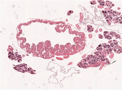 PRESERVED_SPECIMEN; ; ; microslide; ; IZ number 98975; lot count 1; Microslide 01, balsam, salivary gland, serial section; Microslide 02, balsam, salivary gland, serial section; Microsl photo