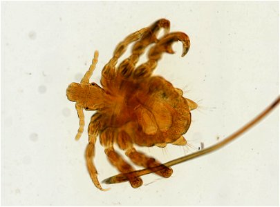 PRESERVED_SPECIMEN; ; ADULT; microslide; ; IZ number 93620; lot count 1; Microslide 01, balsam, whole mount; adult;