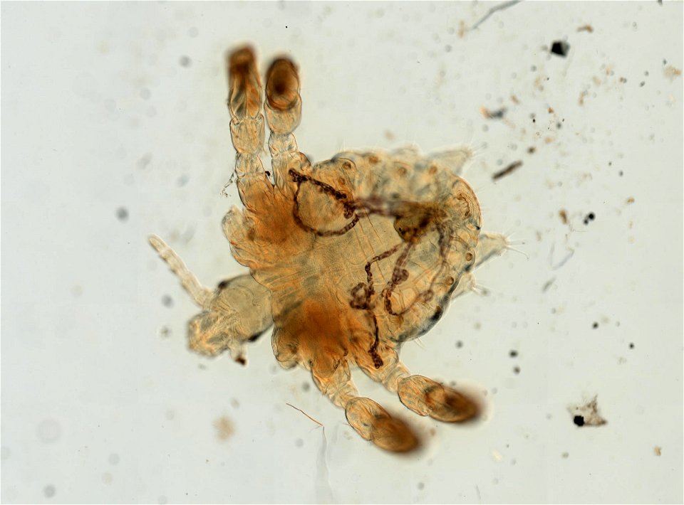 PRESERVED_SPECIMEN; ; ADULT; microslide; ; IZ number 93631; lot count 1; Microslide 01, balsam, whole mount; adult; 1943-01-01T00:00:00Z
