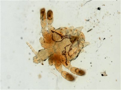 PRESERVED_SPECIMEN; ; ADULT; microslide; ; IZ number 93631; lot count 1; Microslide 01, balsam, whole mount; adult; 1943-01-01T00:00:00Z
