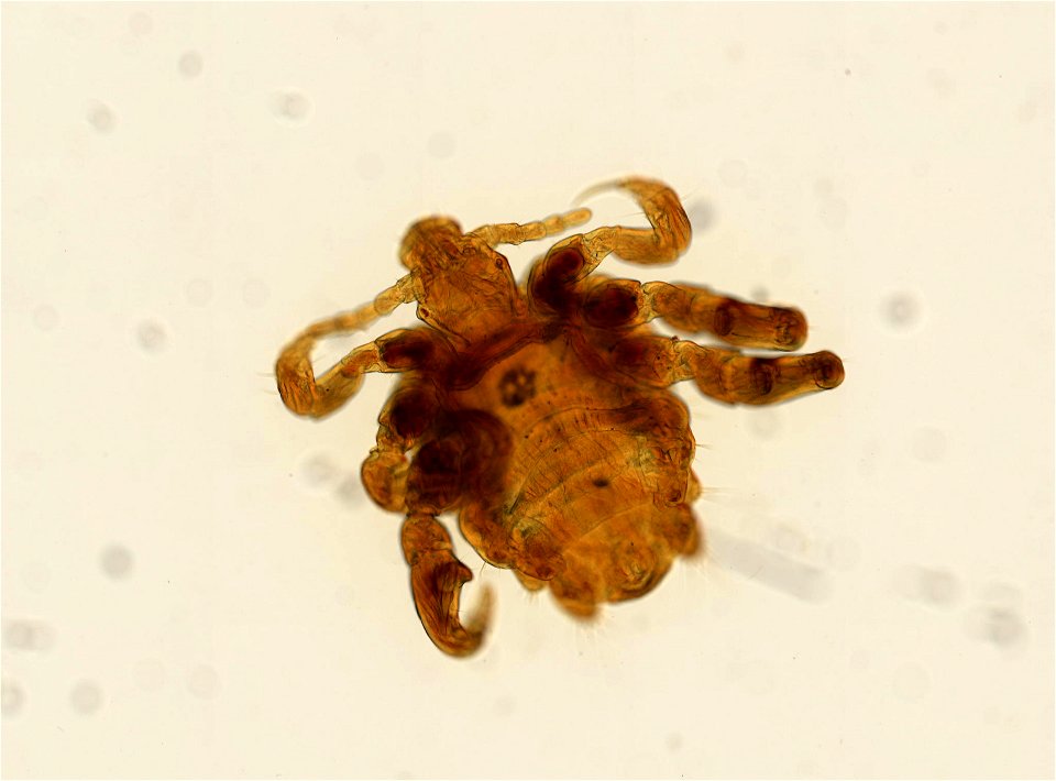 PRESERVED_SPECIMEN; ; ADULT; microslide; ; IZ number 93654; lot count 1; Microslide 01, balsam, whole mount; adult;