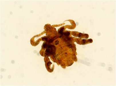 PRESERVED_SPECIMEN; ; ADULT; microslide; ; IZ number 93654; lot count 1; Microslide 01, balsam, whole mount; adult;