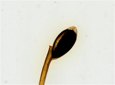 PRESERVED_SPECIMEN; ; ; microslide; ; IZ number 93658; lot count 1; Microslide 01, balsam, whole mount; egg;