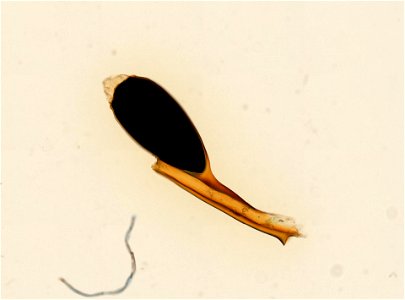 PRESERVED_SPECIMEN; ; ; microslide; ; IZ number 93659; lot count 1; Microslide 01, balsam, whole mount; egg;