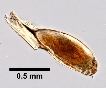 PRESERVED_SPECIMEN; ; ; microslide; ; IZ number 99322; lot count 1; Microslide 01, balsam, whole mount; nit;
