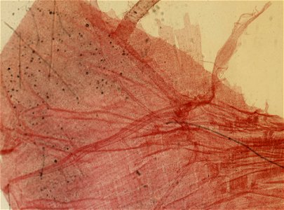 PRESERVED_SPECIMEN; ; ; microslide; ; IZ number 98915; lot count 1; Microslide 01, balsam, alimentary canal, section;