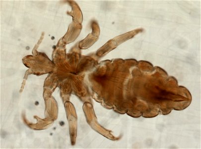 PRESERVED_SPECIMEN; MALE; ; microslide; ; IZ number 93559; lot count 1; Microslide 01, balsam, whole mount; male; other number P9.566;