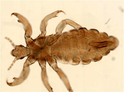 PRESERVED_SPECIMEN; MALE; ; microslide; ; IZ number 93561; lot count 1; Microslide 01, balsam, whole mount; male; other number P9.566;