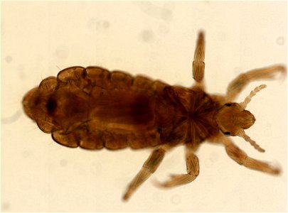 PRESERVED_SPECIMEN; FEMALE; ; microslide; ; IZ number 93567; lot count 1; Microslide 01, balsam, whole mount; female; other number P9.567;