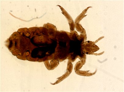 PRESERVED_SPECIMEN; FEMALE; ; microslide; ; IZ number 93568; lot count 1; Microslide 01, balsam, whole mount; female; other number P9.567;