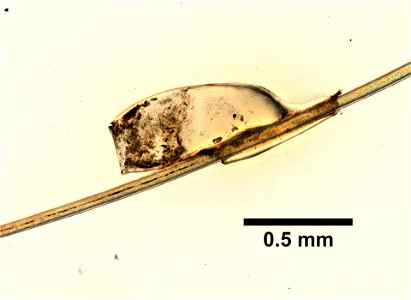 PRESERVED_SPECIMEN; ; ; microslide; ; IZ number 99316; lot count 1; Microslide 01, balsam, whole mount; egg;