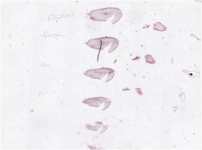 PRESERVED_SPECIMEN; MALE; ; microslide; microslide; ; IZ number 98816; lot count 1; Microslide 01, balsam, serial section; Microslide 02, balsam, serial section; Microslide 03, balsam, seria photo