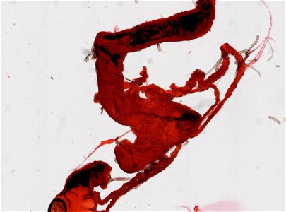 PRESERVED_SPECIMEN; ; ; microslide; ; IZ number 98665; lot count 1; Microslide 01, balsam, alimentary canal;