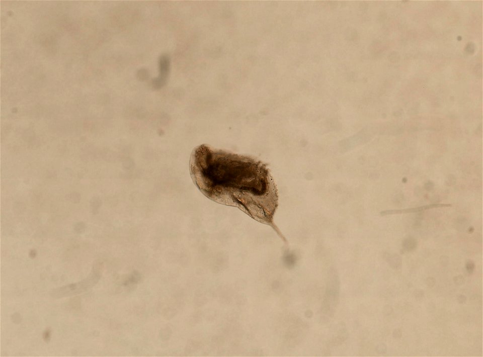 PRESERVED_SPECIMEN; ; ; microslide; HYPOTYPE. See: Brooks, John L. 1957. The systematics of North American Daphnia. Memoirs of the Connecticut Academy of Arts and Sciences. 13: 1-180.; IZ nu