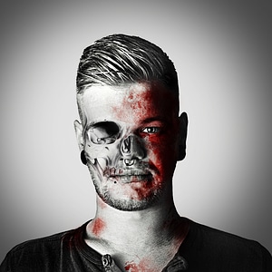 Undead injured accident