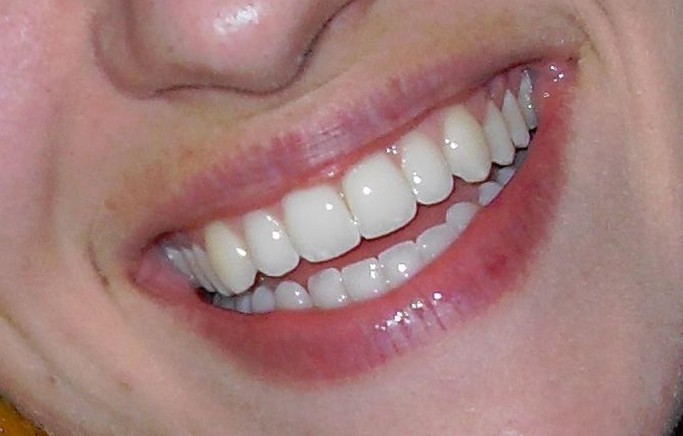 Big Beautiful Smile