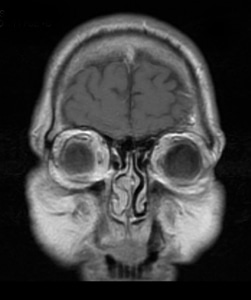 MRI Head Scan photo