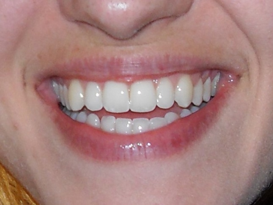 Beautiful Smile Close Up