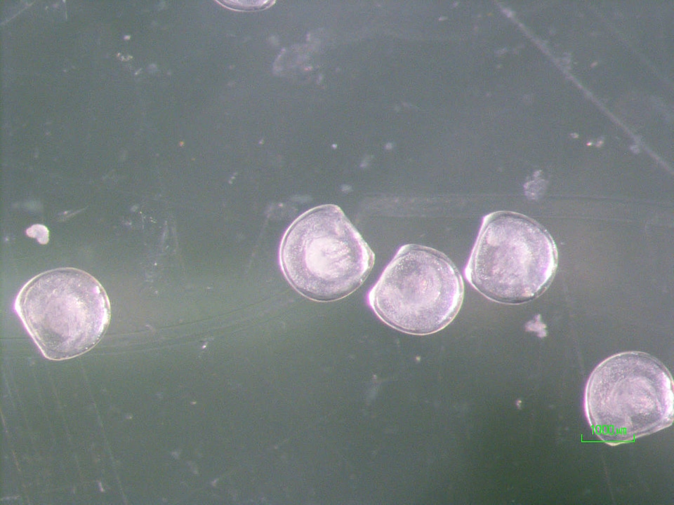 Glochidia of the golden riffleshell