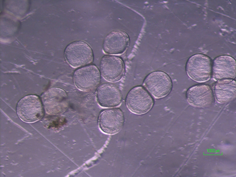 Glochidia of the golden riffleshell-1