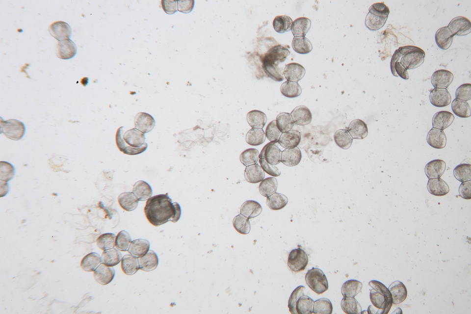 Glochidia under microscope