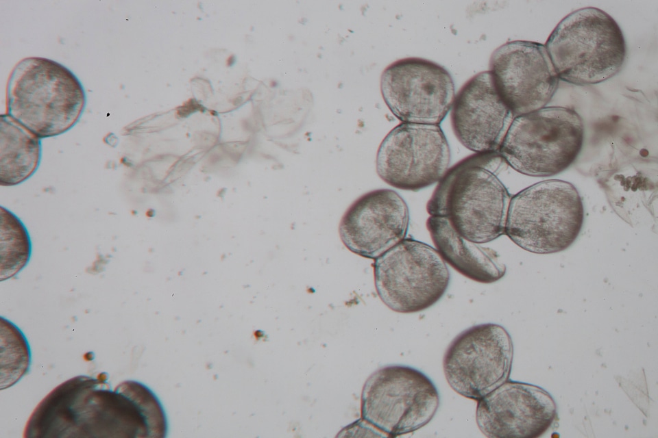 Glochidia under microscope-2