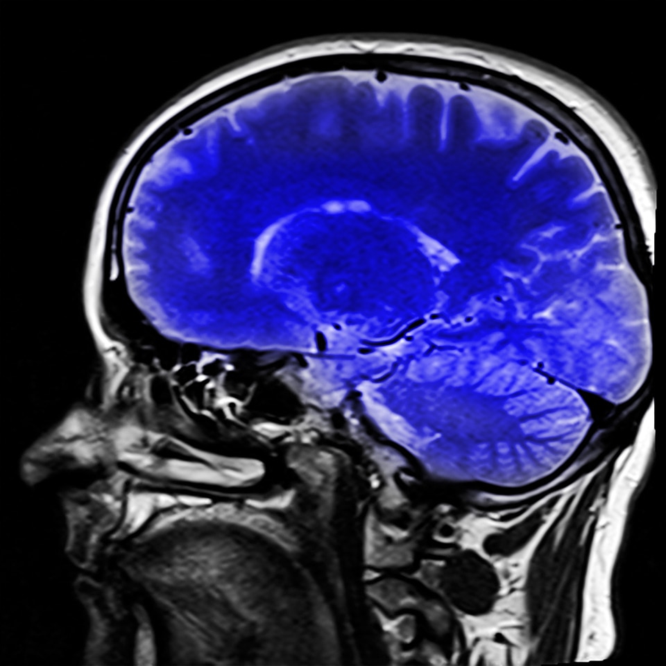 X ray x ray image brain