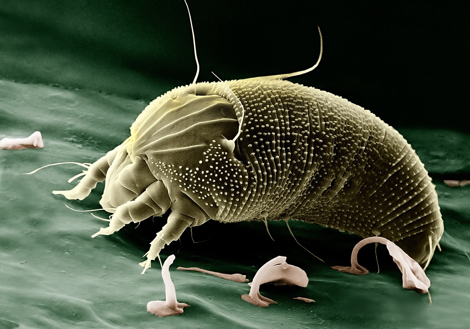 Arachnid spider electron microscope