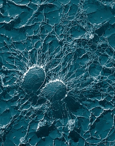 Staphylococcus pathogens disease photo