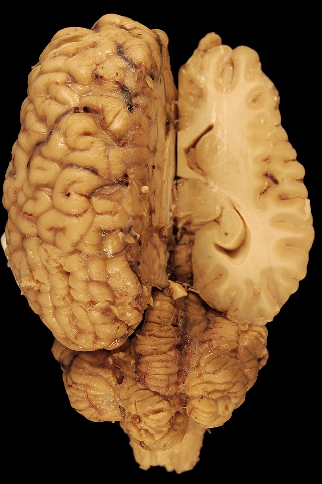 Biology dorsal body