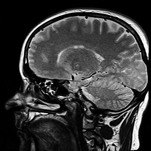 X ray x ray image brain